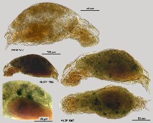 Image courtesy of ANSP (Jersabek et al. 2003) <a href='../../Reference/Index/15798' target='_blank'>[Ref.15798]</a>; females, lateral (572, 1287 upper specimen, 1288 [detail: multinucleated vittelarium]), and ventral (1287 lower specimen) views